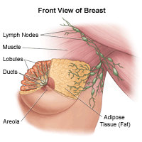 Common Breast Lumps