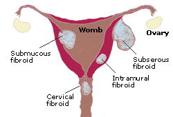 wall of the womb