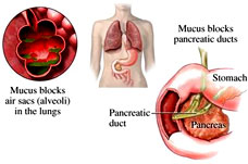 pancreatic doct