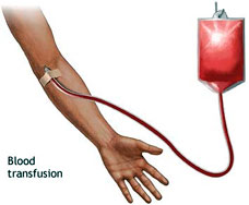 Diseases blood transfution