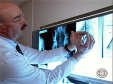 doctor with xray