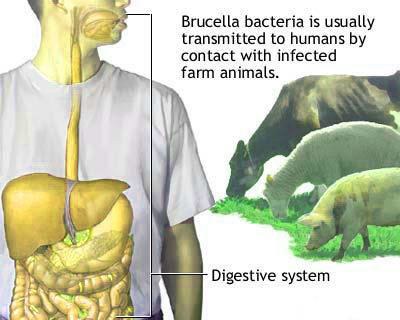 brucella bacteria