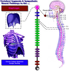 chronicfatiguesyndrome