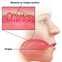 tounge surface
