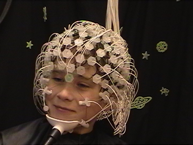 Net for recording the EEG