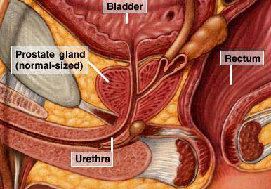 Prostatic Hypertrophy