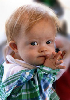 Born with Down Syndrome