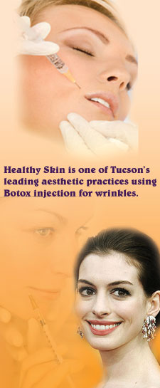 Botox injection for wrinkles