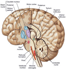 Parkinson's