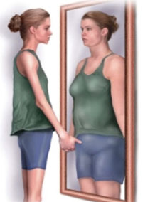 body dysmorphia