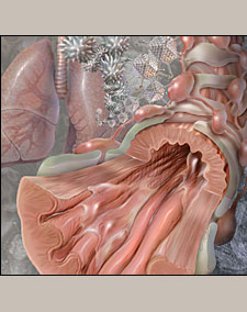 acute bronchitis images
