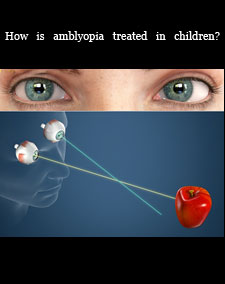 amblyopia treated