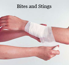 bites and stings