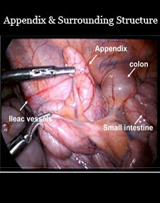 appendix & surrounding structure