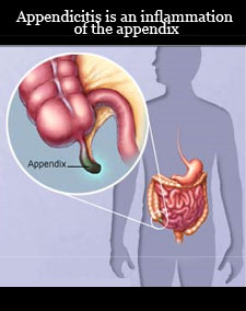 lyx appendix
