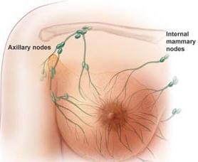 Adjuvant treatment of  Women with Hormone Receptor-Positive Early Breast Cancer